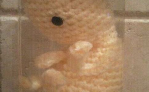 Fetus In A Jar 1