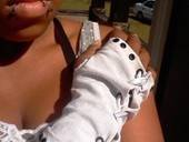 Non Sew Arm Warmer