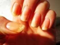 Sos Nail Rescue Plus Nail Designs