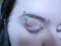 Cover Your Black Eye