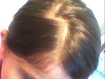 Lightning Bolt Or Zigzag Hair Parting