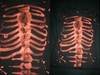 Small_skulltop