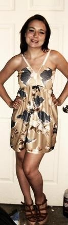 Zipper Dress