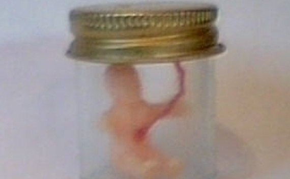 Baby In A Jar