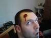 Small_bullet_wound