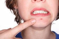 Let's Kill Pimples!
